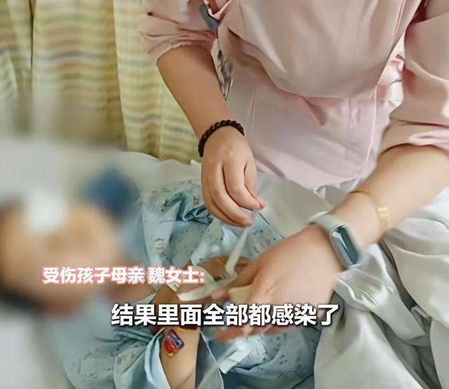江西一5岁男孩在幼儿园被戳伤致左眼失明<strong></p>
<p>p2p网贷理财</strong>，家长称老师用猪油涂抹试图消肿