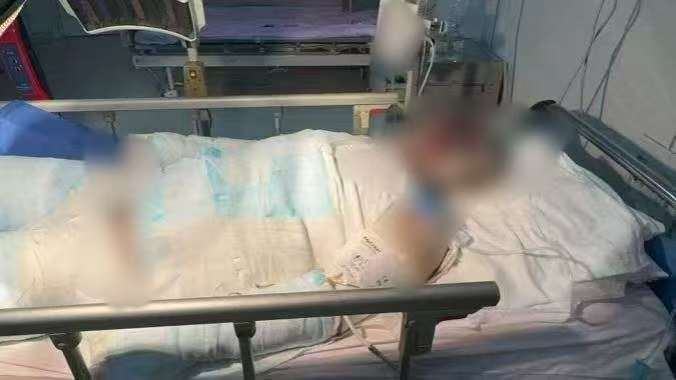 父子在哈尔滨一亲戚公司上班遇爆炸全身烧伤<strong></p>
<p>公募理财</strong>，治疗花费近百万公司拒赔偿？亲戚回应