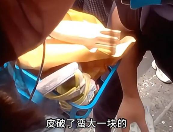 看着都疼<strong></p>
<p>哪家银行理财产品</strong>！上海街头一男子突然求助：10岁女儿被死死卡住！这个行为太危险→