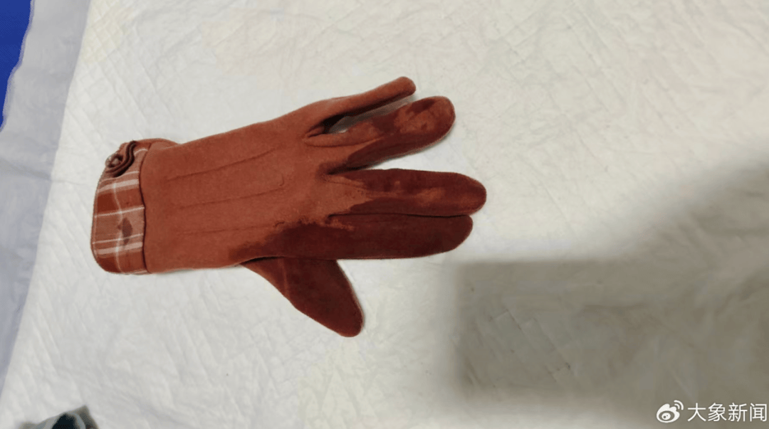 河南一男子街头挥刀乱刺<strong></p>
<p>保本保息理财产品</strong>，被休假女警一脚踢落凶器！女警面部缝合30余针，手套被血浸透